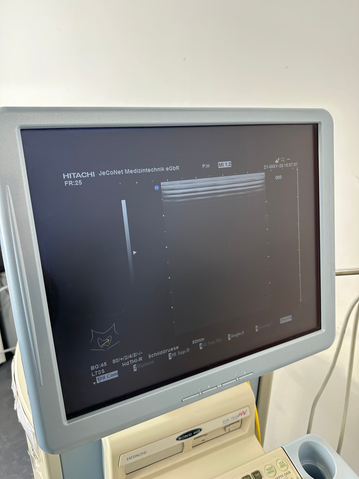 Hitachi EUB-7500A Ultraschallfarbdoppler inkl. 2 Sonden
