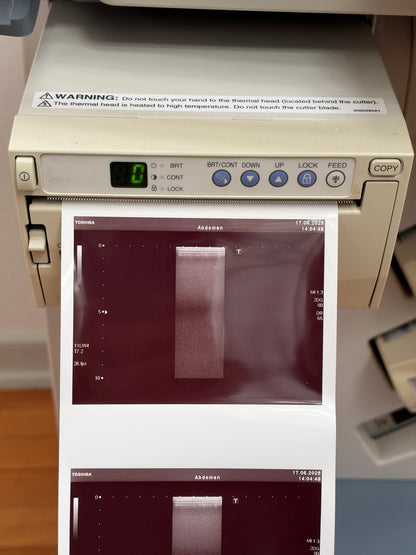 Toshiba SSA-660 A Xario Ultraschallfarbdoppler
