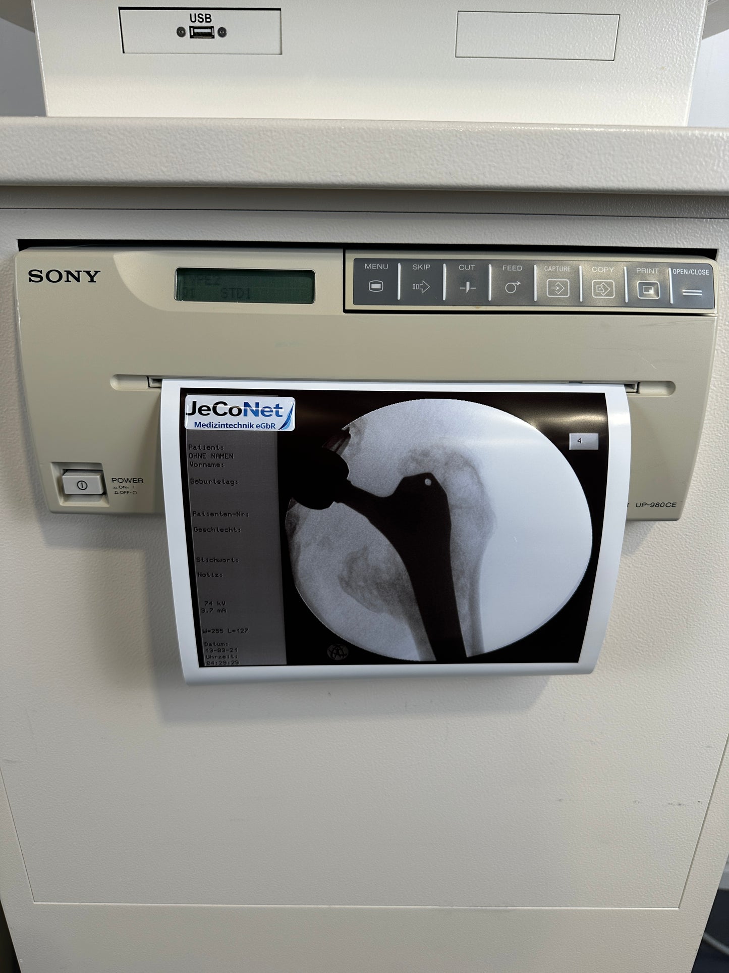 Ziehm Imaging Ziehm 8000 mobiler C-Bogen – Röntgenanlage mit Doppelmonitor – Bj. 2005