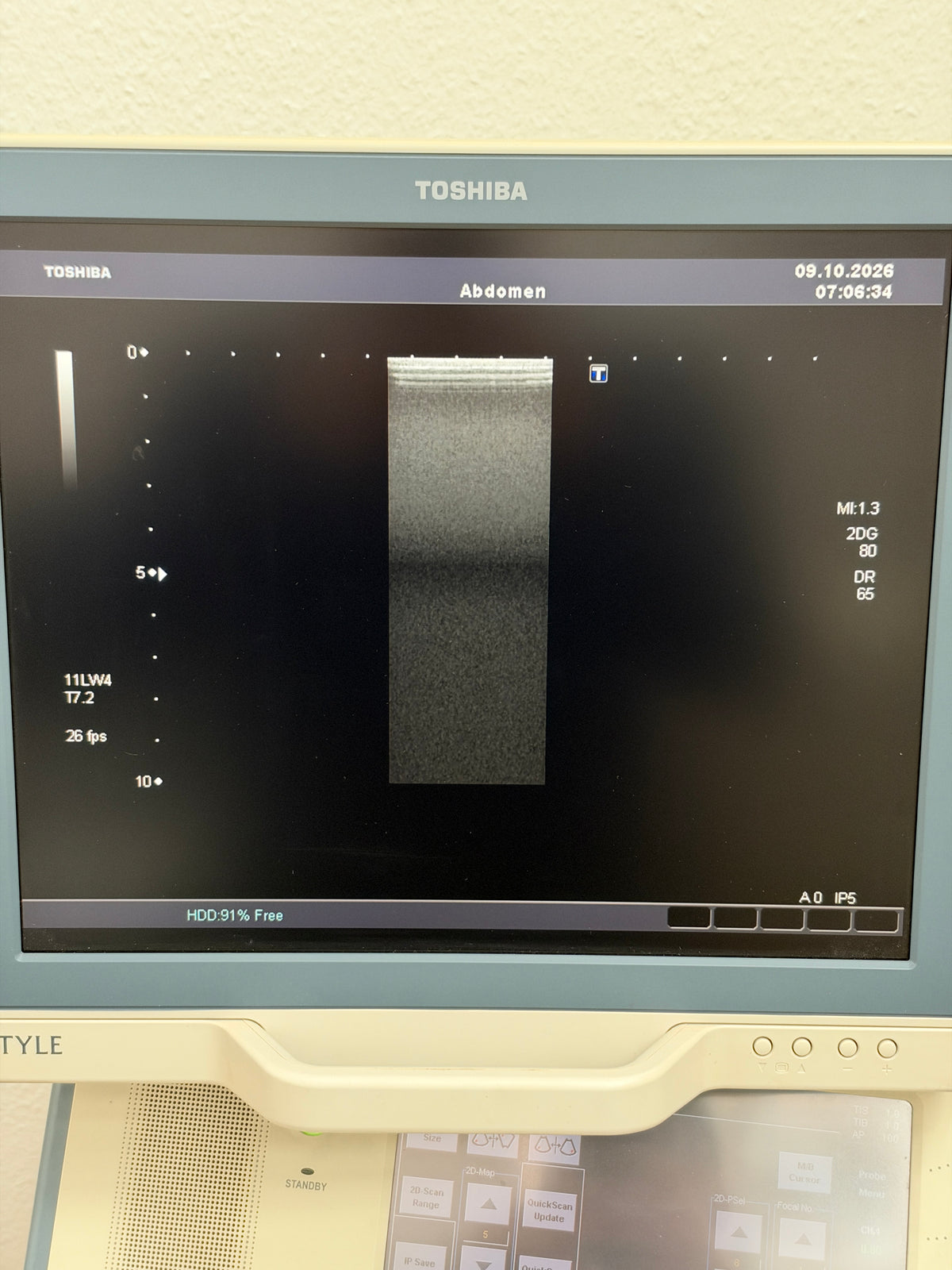 Toshiba SSA-660 A Xario Ultraschallfarbdoppler