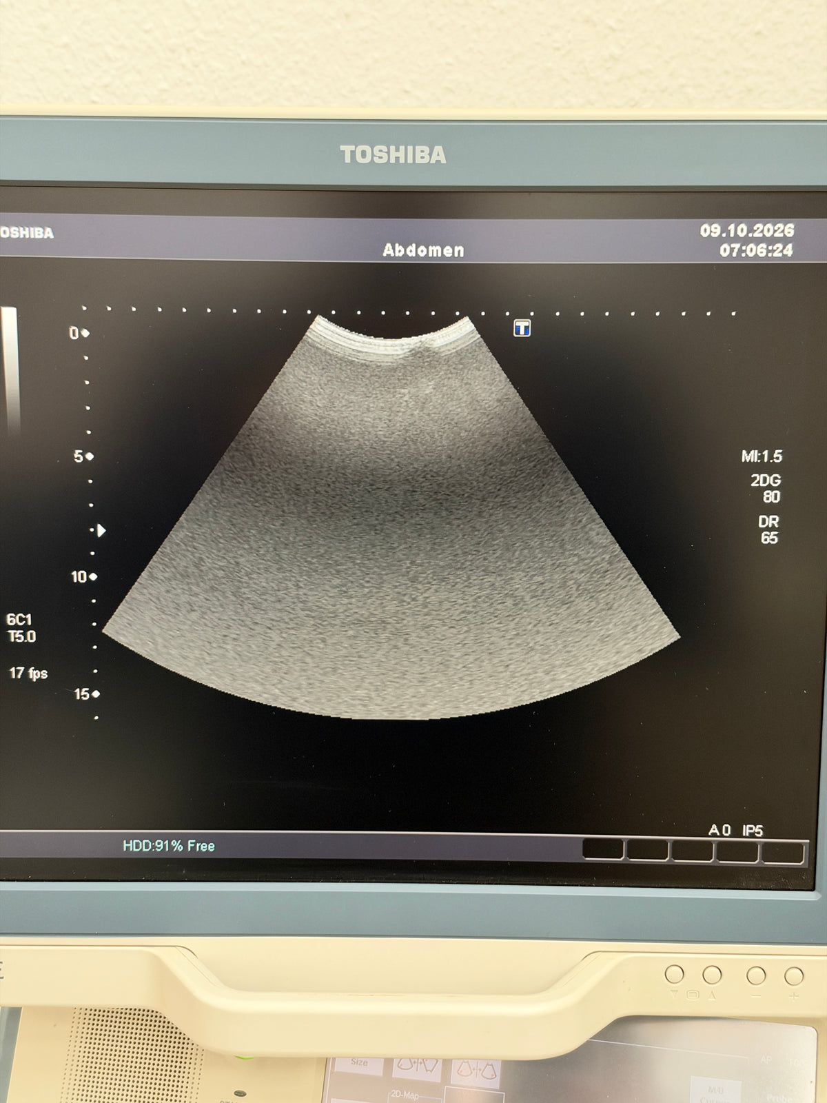 Toshiba SSA-660 A Xario Ultraschallfarbdoppler